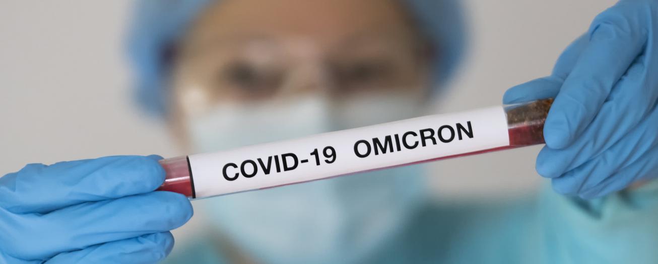 País registra cifra récord de casos por COVID-19