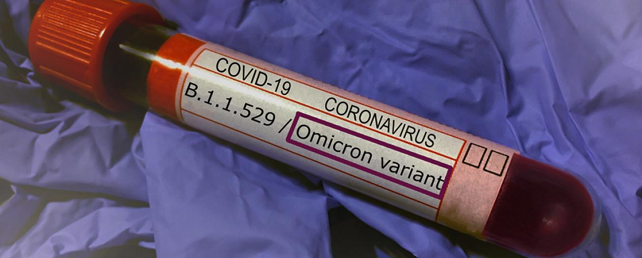 Hospitalizaciones y fallecimientos COVID-19 se mantienen estables, aunque casos continúan en franco aumento