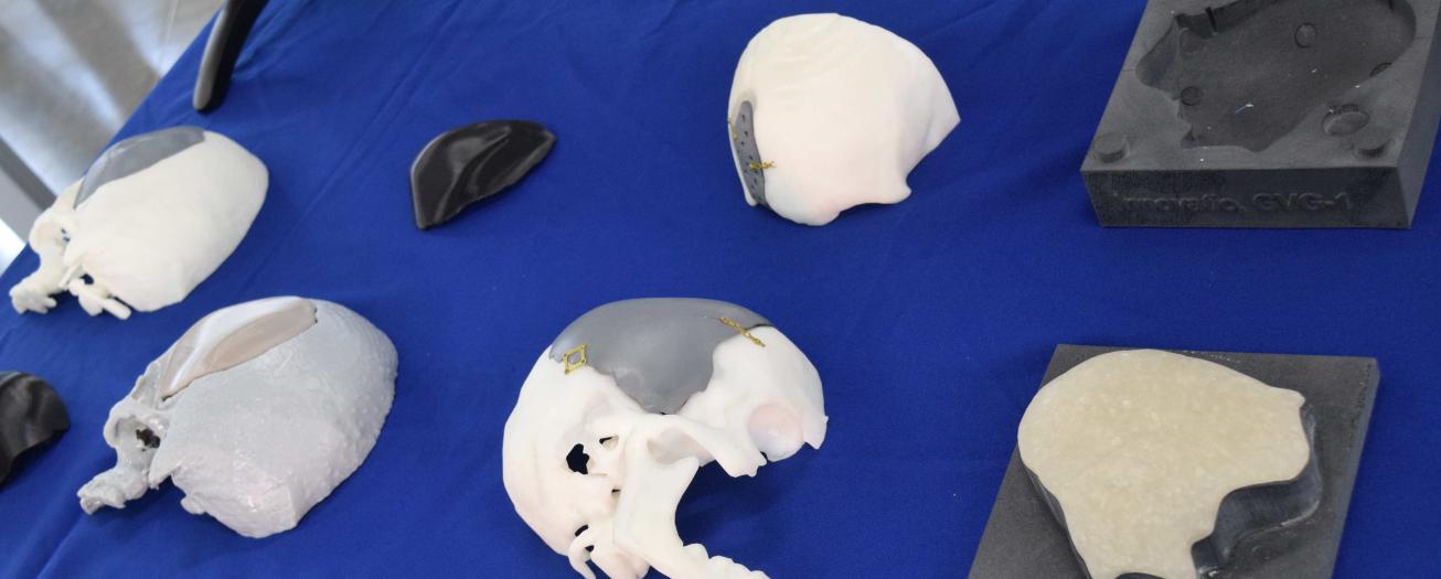 El INA desarrollará prótesis craneales en 3D para pacientes de la CCSS