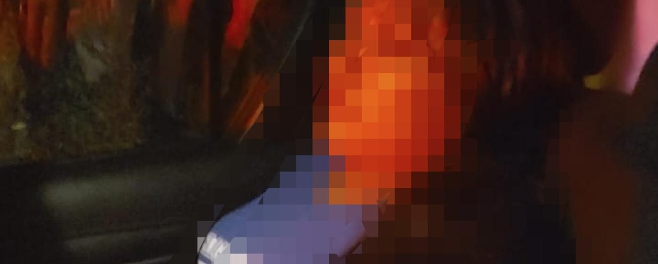 Pleito entre indocumentados termina con agresión con cuchillo