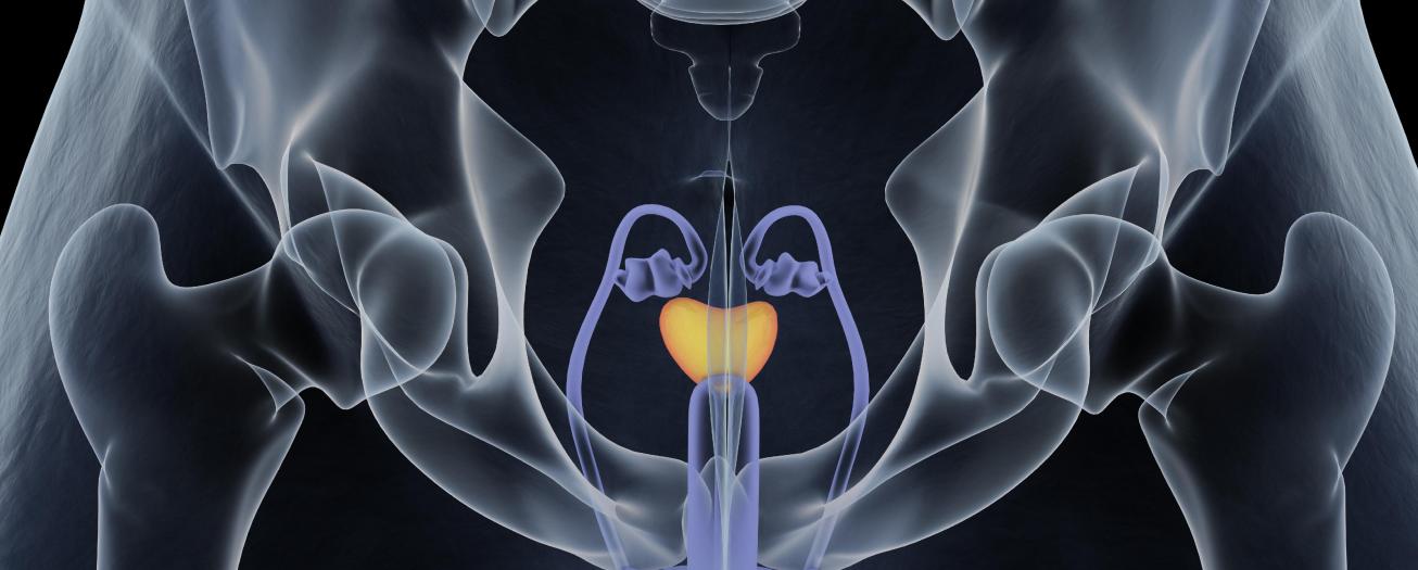 Cáncer de próstata alcanza el primer lugar de mortalidad en el país 