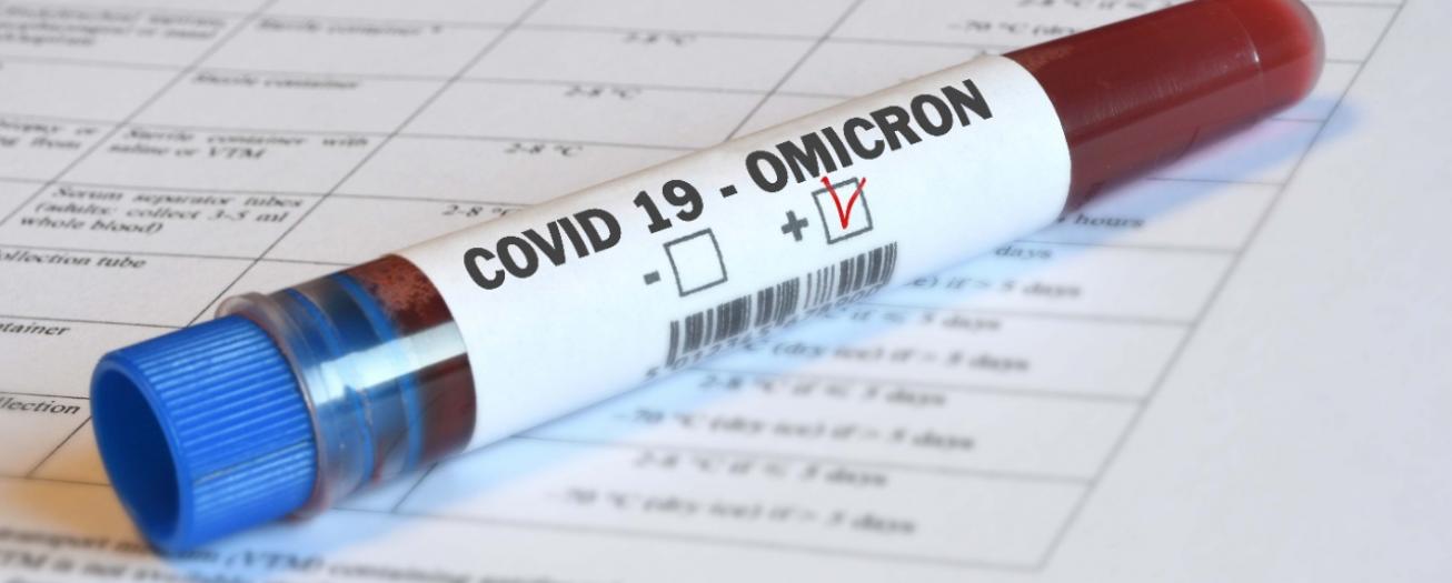 Casos COVID-19 presentan leve disminución luego de seis semanas consecutivas al alza