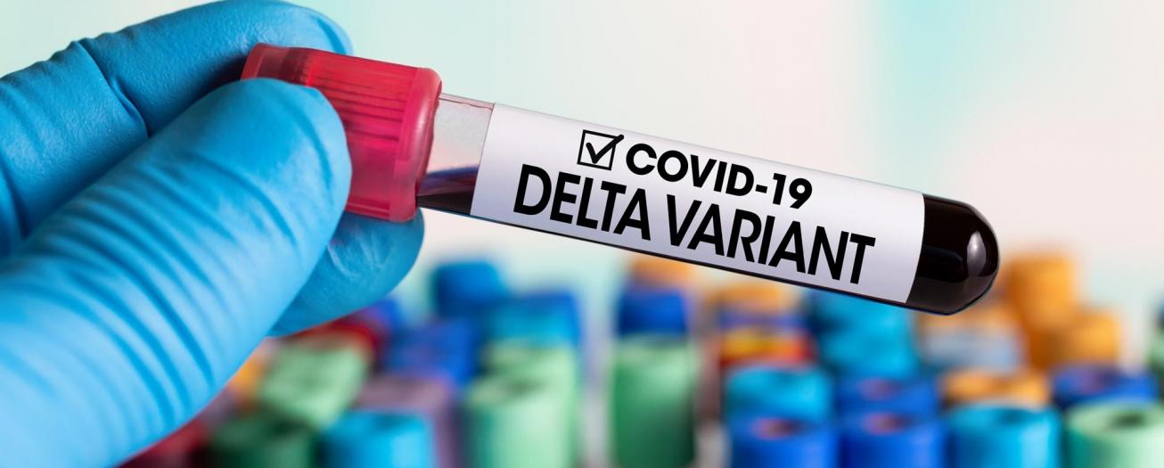 Alajuela y San Ramón ya registran casos con la variante Delta del SARS-CoV-2