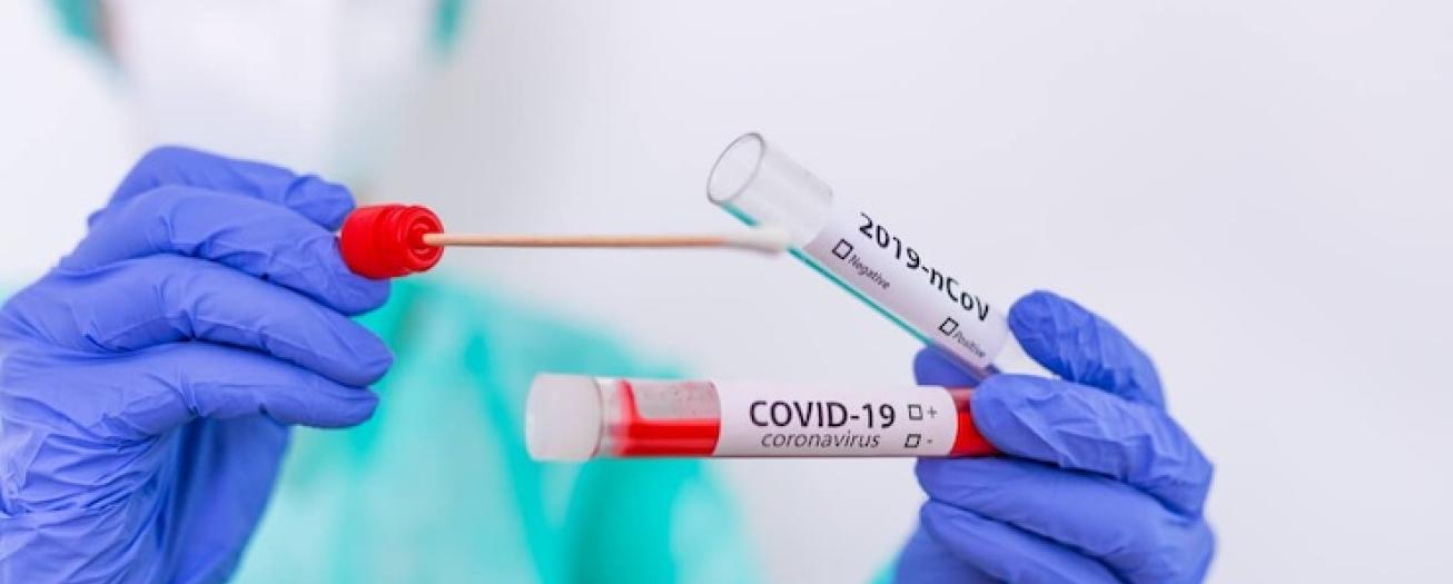  Nuevos ingresos hospitalarios COVID-19 disminuyeron 20% en segunda semana de marzo